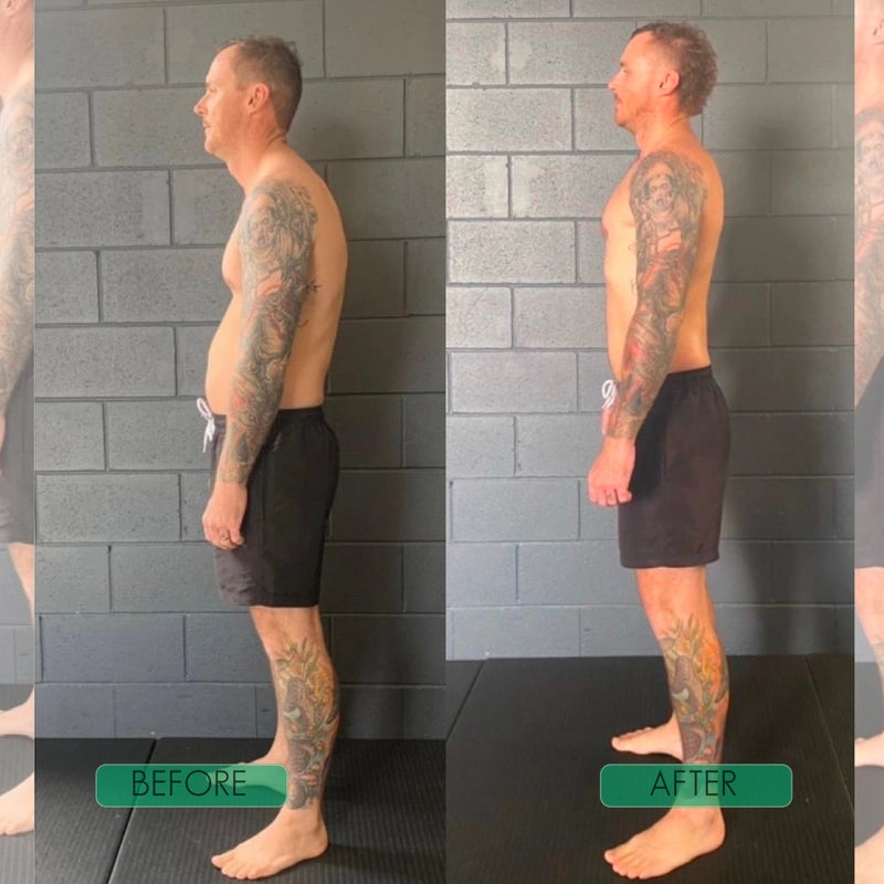 True Form Posture Corrector