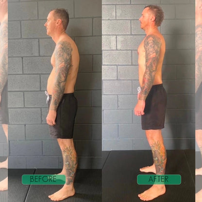 True Form Posture Corrector